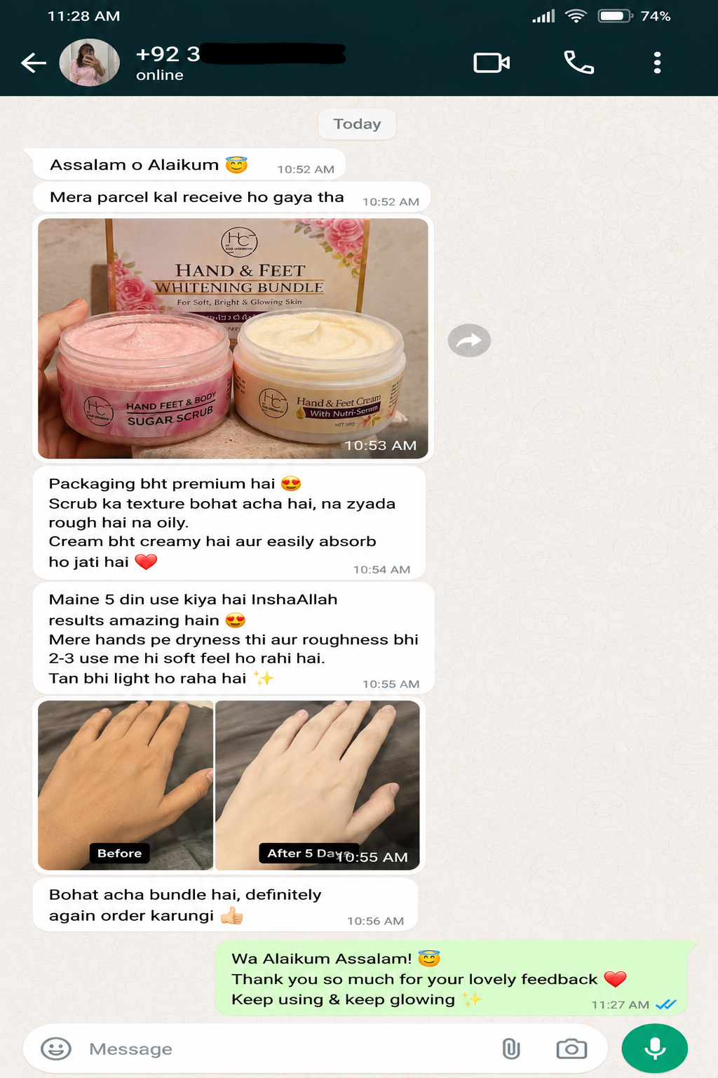 HAND FEET WHITENING BUNDLE