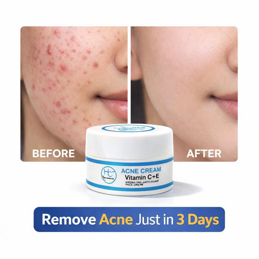 SKIN RETREAT CREAM / BUY 1 GET 1 FREE