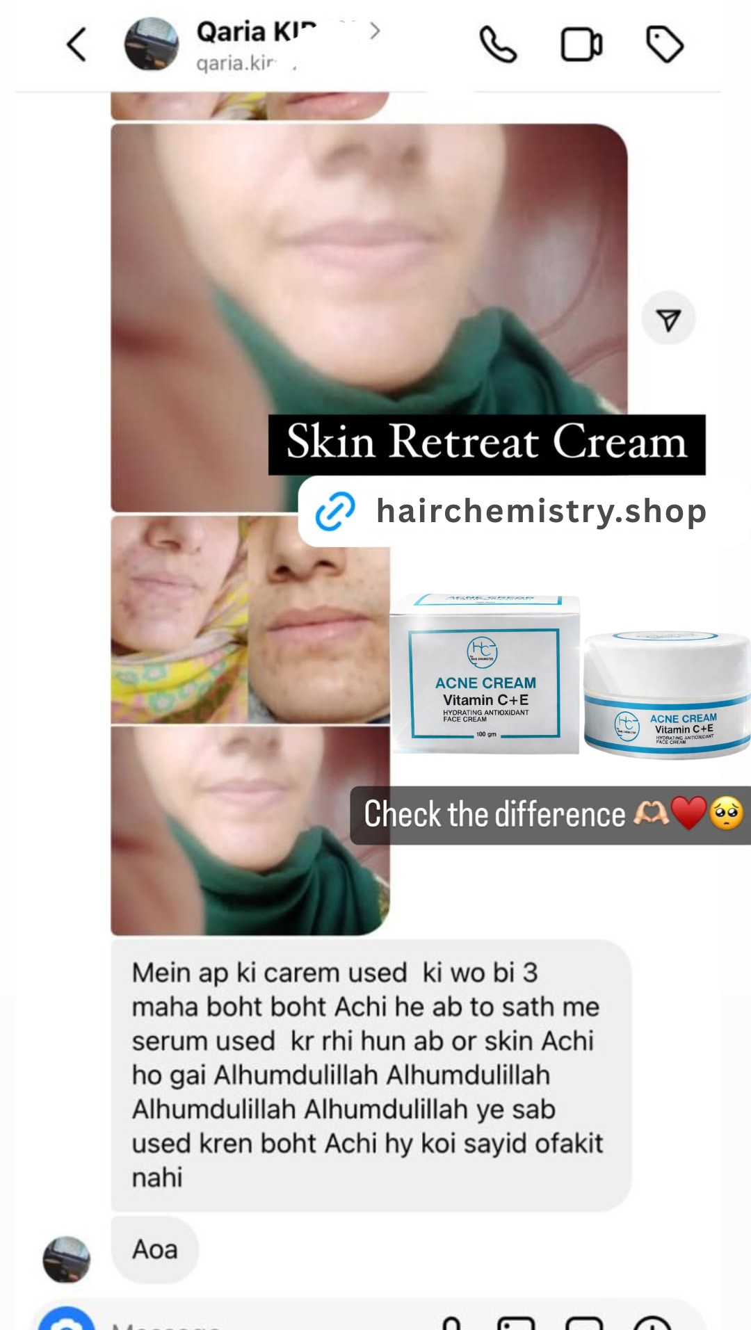 SKIN RETREAT CREAM / BUY 1 GET 1 FREE
