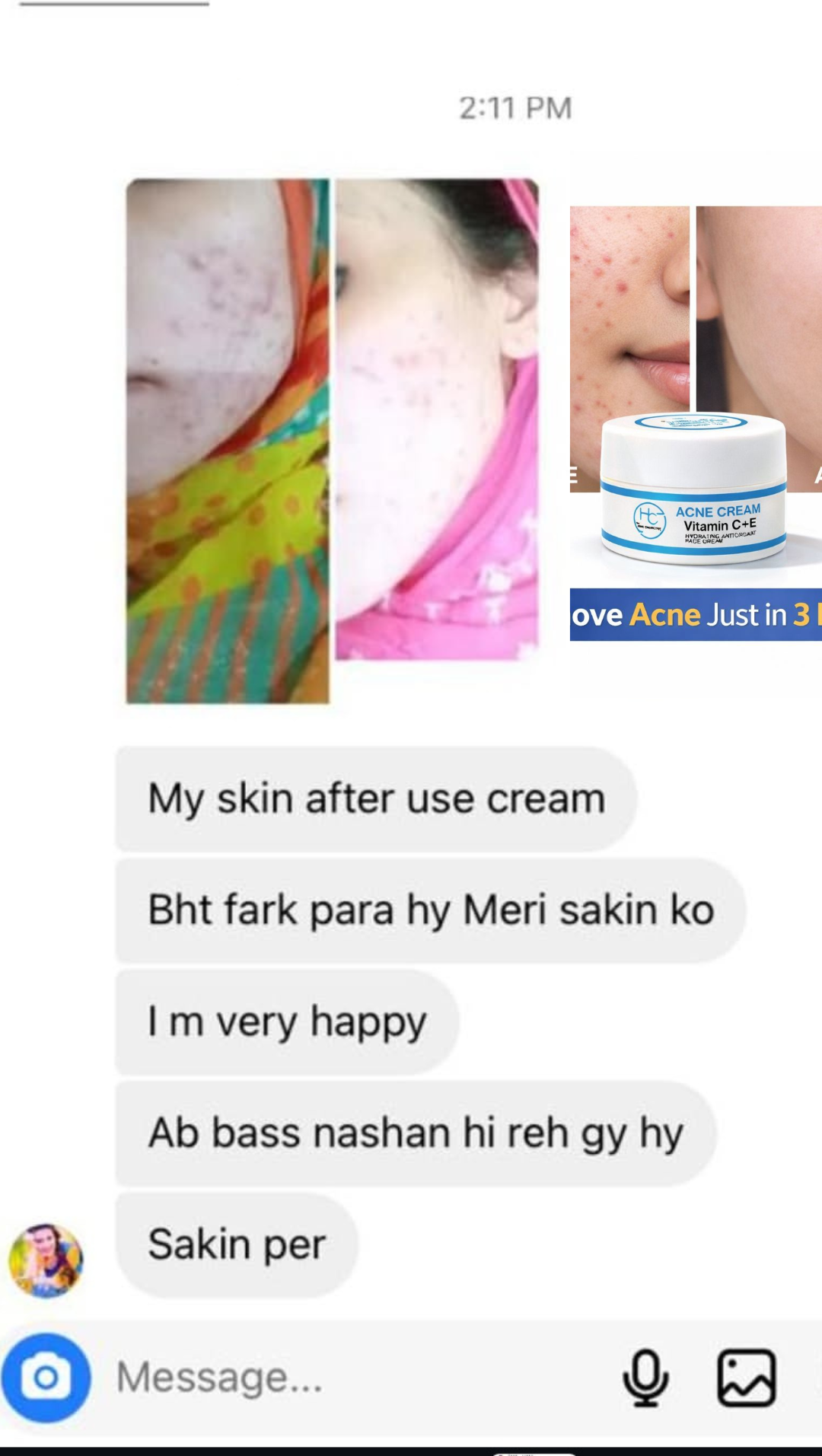 SKIN RETREAT CREAM / BUY 1 GET 1 FREE