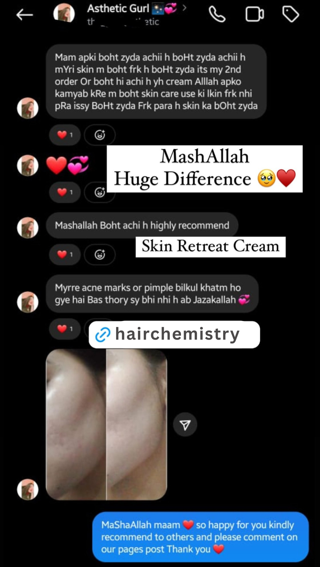 SKIN RETREAT CREAM / BUY 1 GET 1 FREE