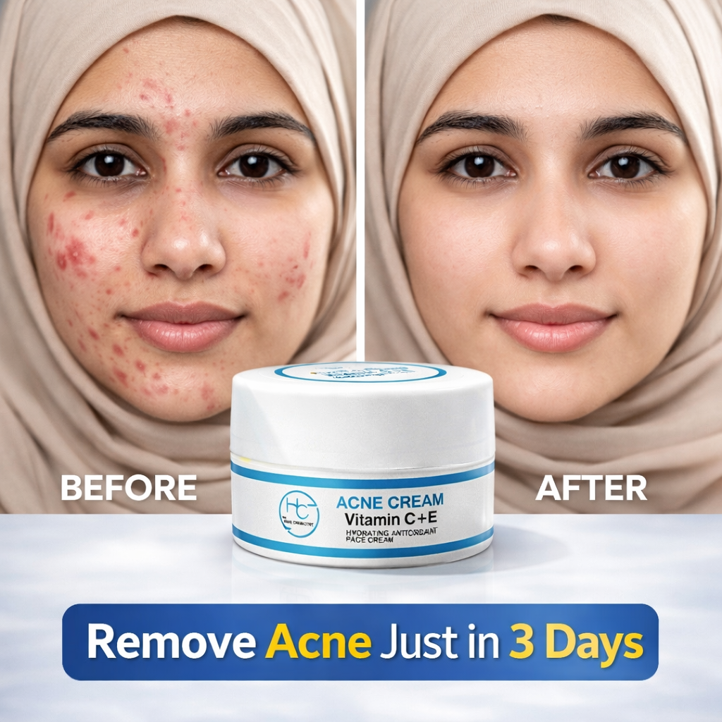 SKIN RETREAT CREAM / BUY 1 GET 1 FREE